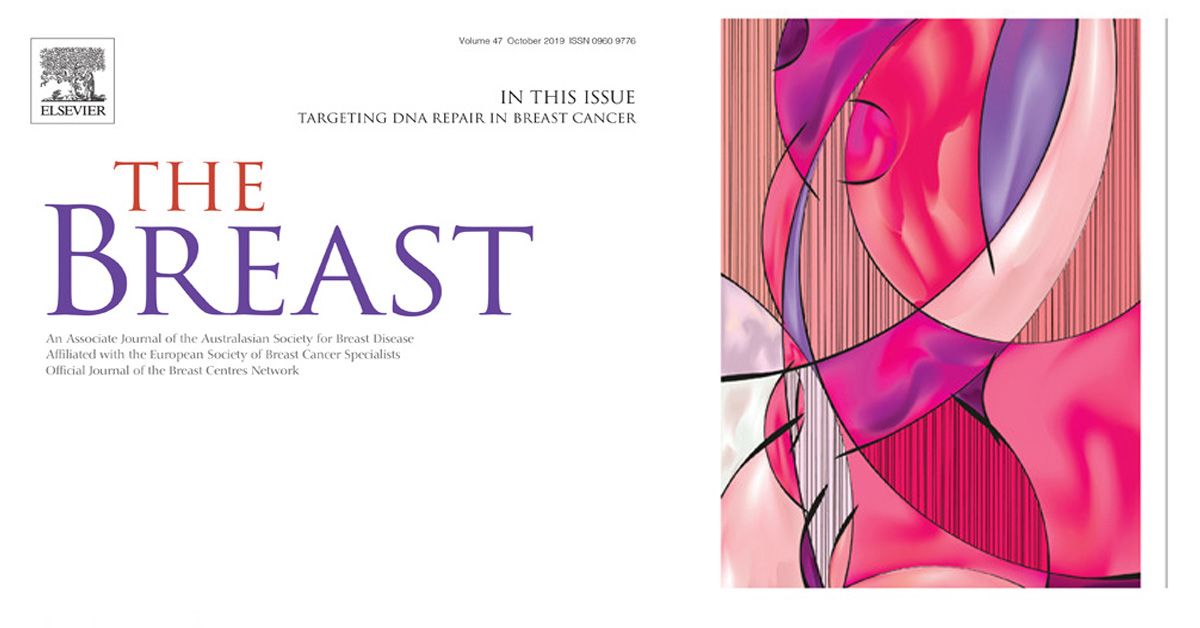 Bilateral bi-pedicle skin reducing nipple sparing mastectomy in a BRCA-1 mutation carrier with gigantomastia